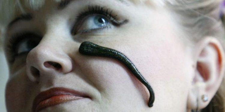 8 kurat e çuditshme nga e shkuara! Nga shurupi me morfinë, pomada e mërkurit tek shushunjat e uji radioaktiv!