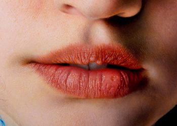 Marco Grassi, italiani hiperrealist që përshkruan përmes një ligjërimi dehës të penelit thëllësinë e qenies