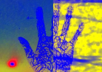 Shkencëtarët mund të shohin brenda trupit tuaj nëpërmjet lazerit që vepron si ultratinguj, pa realizuar kontakt fizik