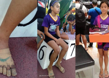 11-vjeçarja Rhea Bullos që fiton 3 medalje të arta në atletikë, me këpucë të bëra me fashë