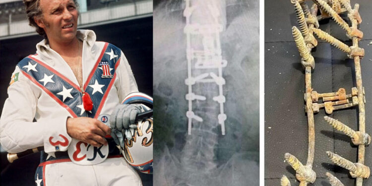 Shtylla kurrizore e një legjende, radiografia e Evel Knievel-it, atij që shtyti tej caqet e së mundshmes