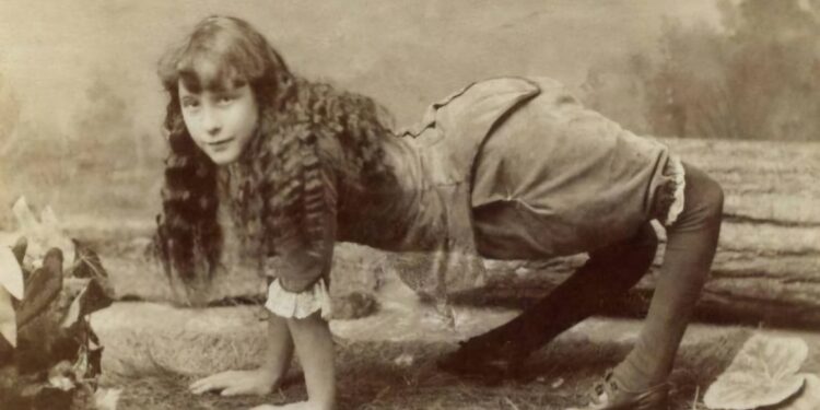 Ella Harper, historia e çuditshme e “Vajzës deve”, që e ktheu fatkeqësinë në mundësi fame