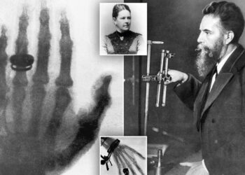 Zbulim aksidental i Wilhelm Röntgen që revolucionalizoi mjekësinë, si lindën rrezet X dhe Anna Bertha, gruaja që pa vdekjen e saj