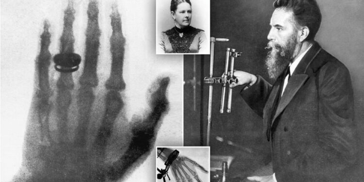 Zbulim aksidental i Wilhelm Röntgen që revolucionalizoi mjekësinë, si lindën rrezet X dhe Anna Bertha, gruaja që pa vdekjen e saj