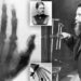 Zbulim aksidental i Wilhelm Röntgen që revolucionalizoi mjekësinë, si lindën rrezet X dhe Anna Bertha, gruaja që pa vdekjen e saj
