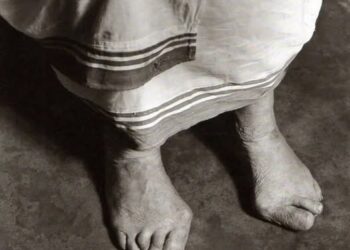 Këmbët e Nënë Terezës, këmbët e deformuara nga lodhja dhe mundimet, këmbët që ecën mbi dhembje në rrugën e kalvarit