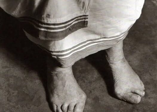 Këmbët e Nënë Terezës, këmbët e deformuara nga lodhja dhe mundimet, këmbët që ecën mbi dhembje në rrugën e kalvarit