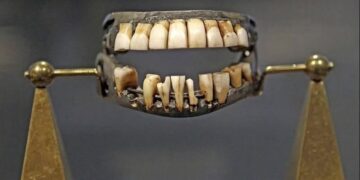 Protezat e Washingtonit, një përzierje e dhimbjes, teknologjisë dhe paradoksit moral_Albert Vataj