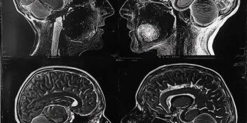 Agjërimi, si një praktikë që fton trupin të rigjenerohet dhe mendjen të rifitojë kontrollin