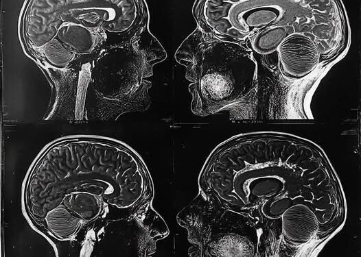 Agjërimi, si një praktikë që fton trupin të rigjenerohet dhe mendjen të rifitojë kontrollin