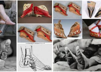 Sakrificat ekstreme, çmimi që duhet të paguanin gratë në emër të bukurisë dhe statusit