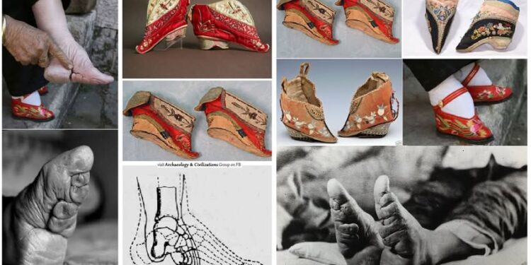 Sakrificat ekstreme, çmimi që duhet të paguanin gratë në emër të bukurisë dhe statusit